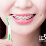 Cơ sở niềng răng uy tín tại Đà Nẵng