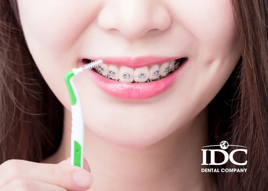 Cơ sở niềng răng uy tín tại Đà Nẵng