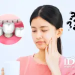 sau khi boc rang su bi e buot