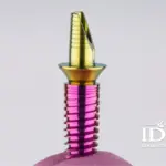 What Is an Abutment in Dental Implants?