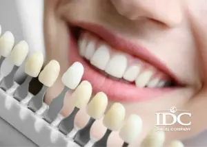 Top Cosmetic Dental Procedures for a Perfect Smile Makeover