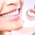 Affordable Cosmetic Dentistry Packages in Da Nang City