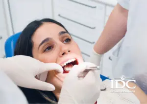 Top Cosmetic Dental Procedures for a Perfect Smile Makeover