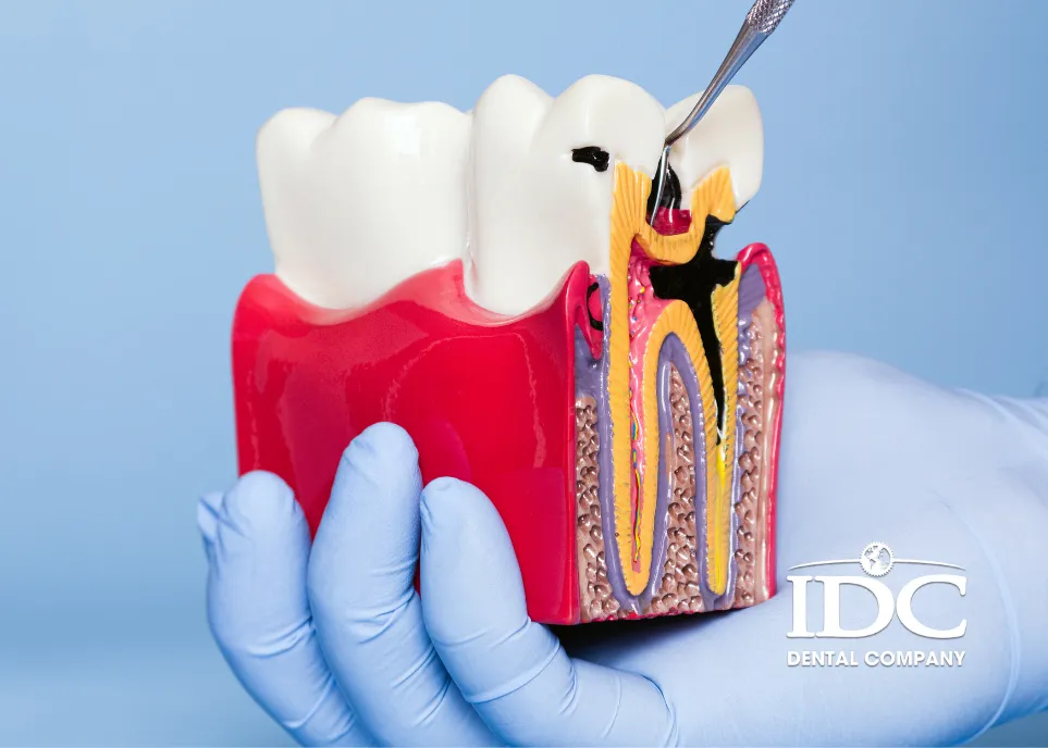 Dental Cavity Treatment in Da Nang