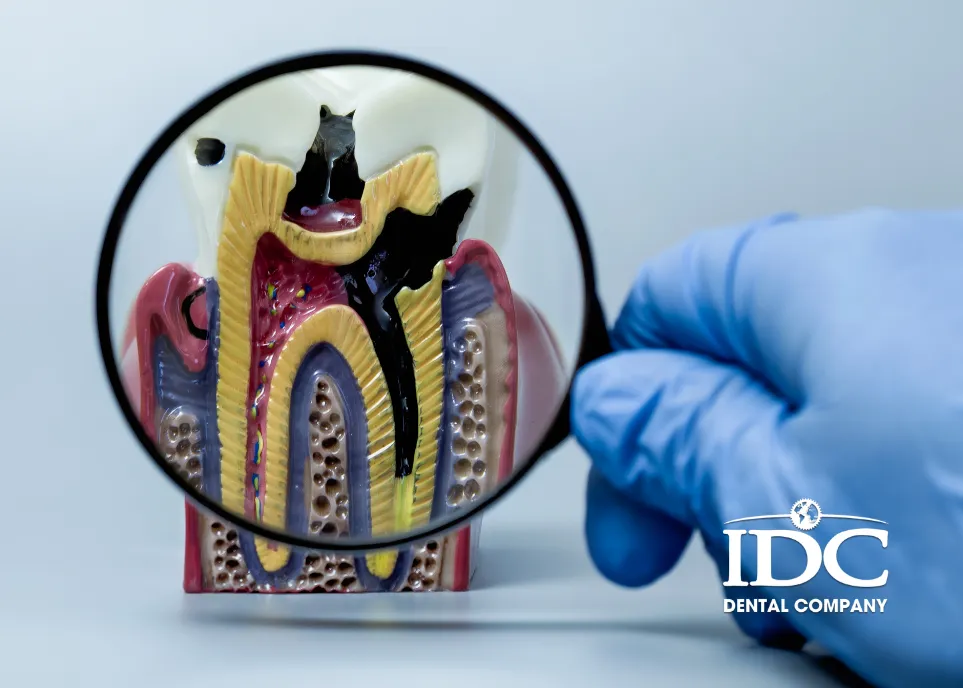 Dental Cavity Treatment in Da Nang