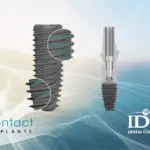 Kontact Implant