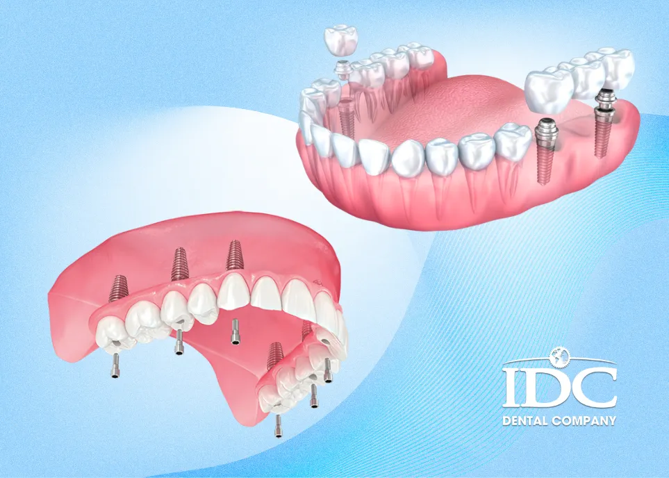 Price list for dental implant packages in Da Nang City