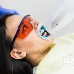 Teeth Whitening Price in Da Nang