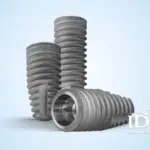 What Is an Implant Fixture?