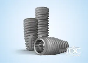 What Is an Implant Fixture?