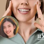 co nen nieng rang khenh khong