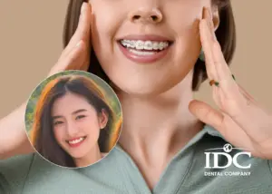 Có nên niềng răng Invisalign không? Ưu nhược điểm chi tiết