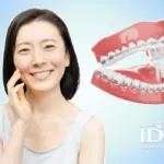 Có nên niềng răng ở tuổi 40 không?