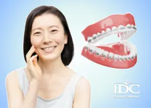 Có nên niềng răng cho trẻ 11 tuổi không? Thời điểm vàng hay không?