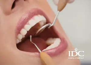 Lắp răng sứ có niềng răng được không?