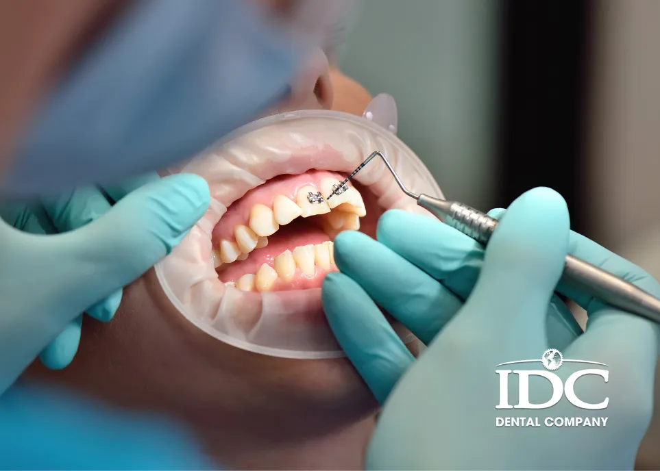 Lớn tuổi có nên niềng răng không?