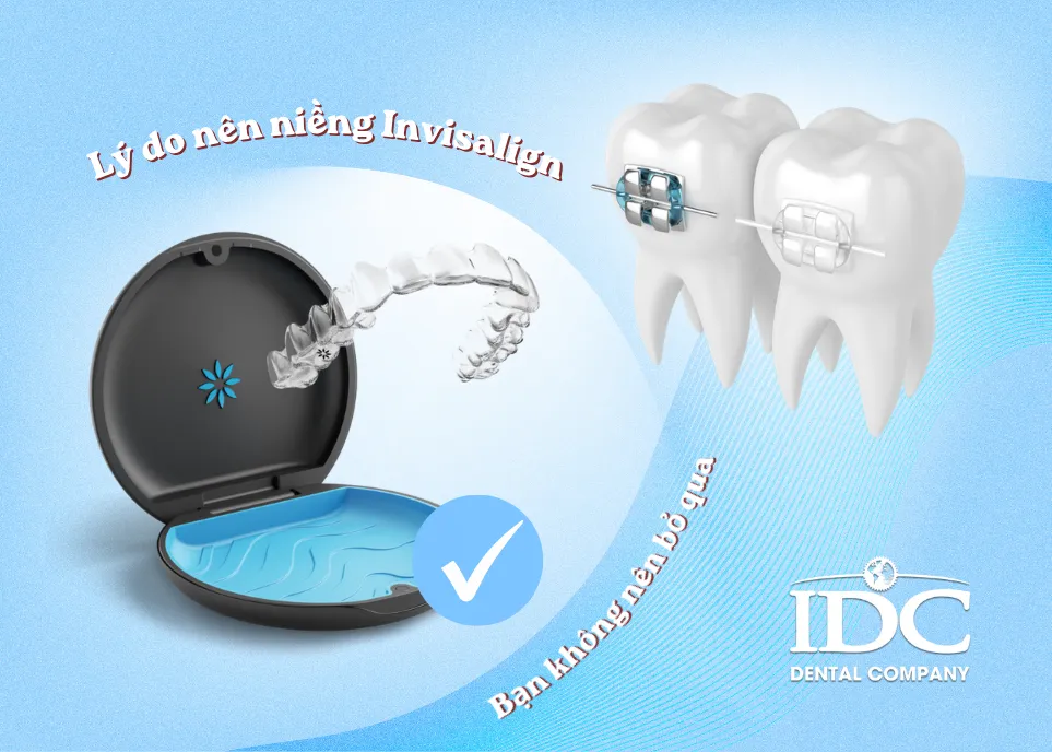 Niềng răng không mắc cài Invisalign
