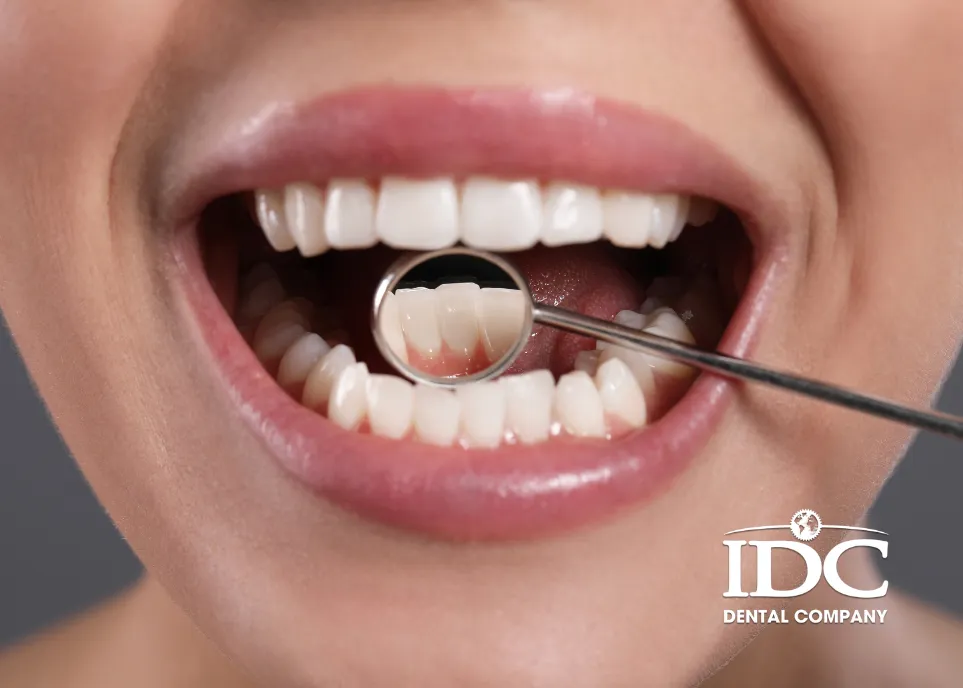 Người mắc bệnh nha chu nặng