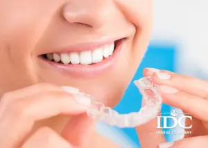 Bị móm có nên niềng răng không? Giải pháp chỉnh nha hiệu quả cho hàm móm