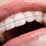 nieng rang mac cai pha le