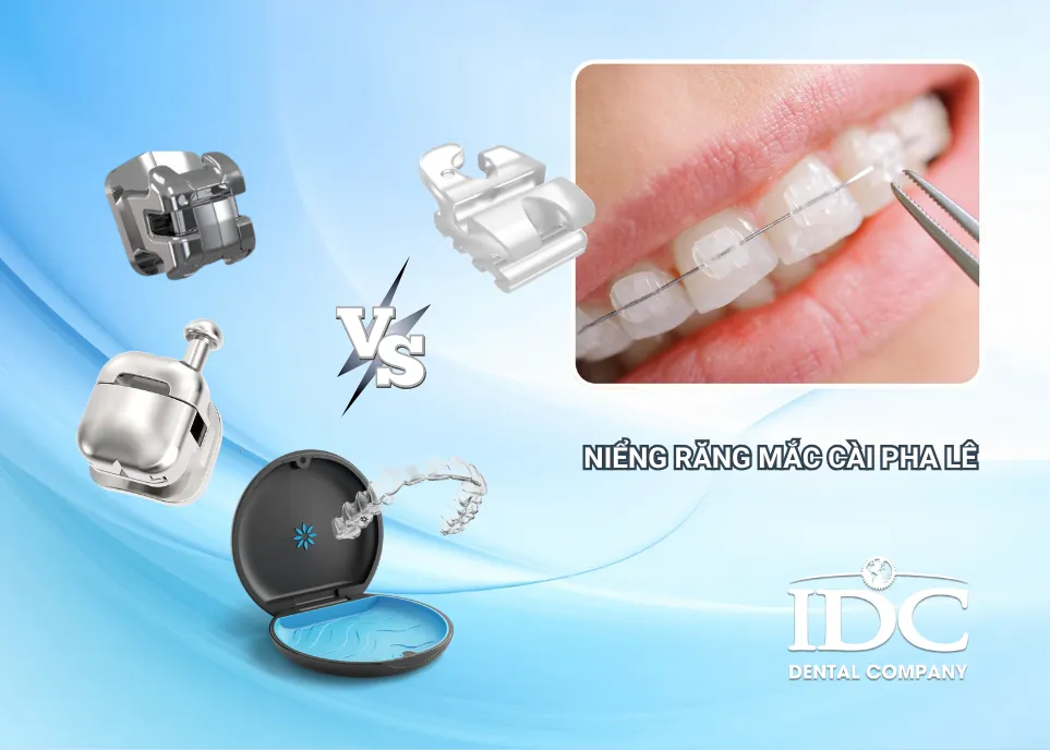 So sánh mắc cài pha lê với các phương pháp khác