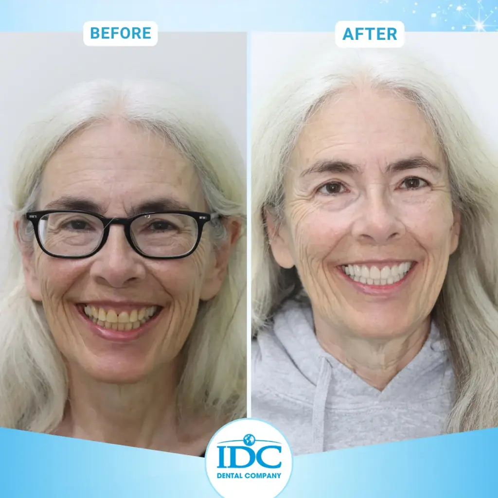 International Patients Receiving Dental Treatment at IDC Danang Dental Clinic