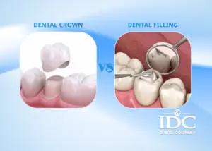 Nobel Biocare Implant in Da Nang: High Quality at Affordable Prices