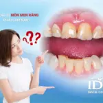 Răng bị mòn men răng phải làm sao?