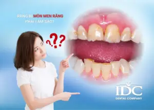 Chữa tủy răng có đau không? Sự thật bạn nên biết