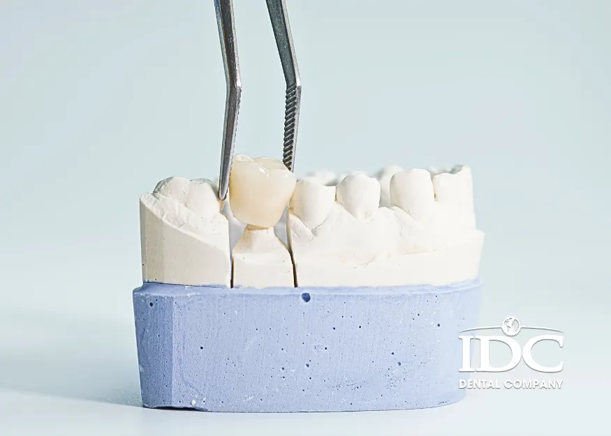 Types of Dental Crowns