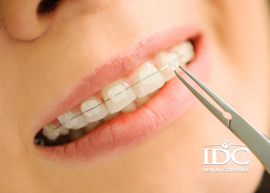 What Are Ceramic Braces?