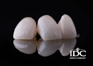 What Is a Porcelain Crown?