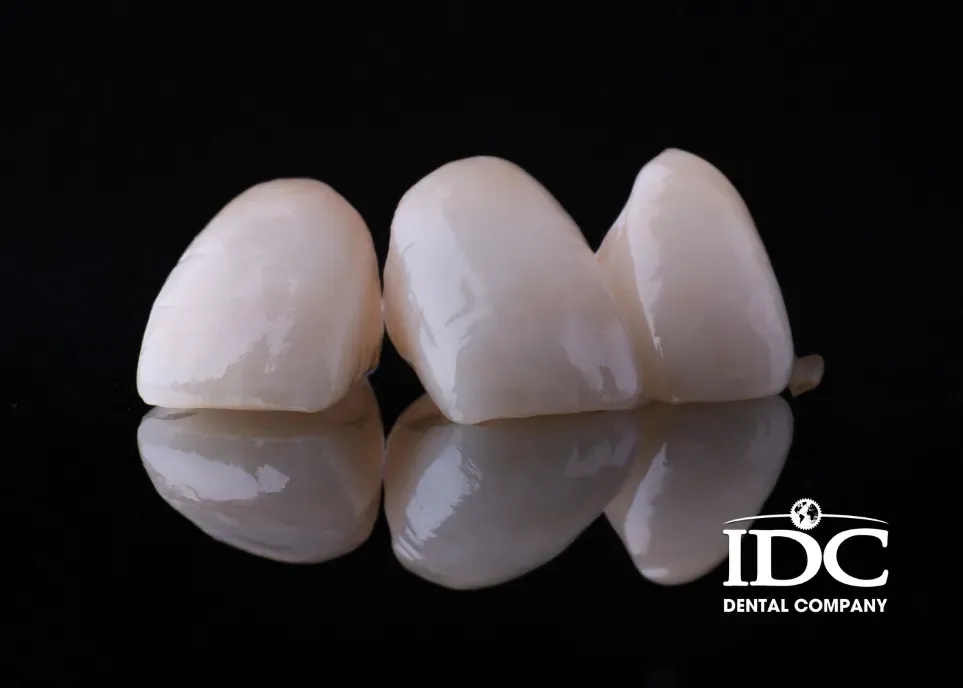 What Is a Porcelain Crown 1