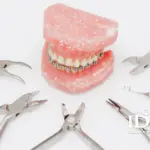 When Is Orthodontic Care Recommended?