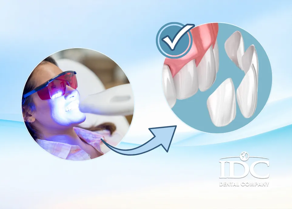 When Should You Choose Porcelain Dental Veneers Instead of Whitening?