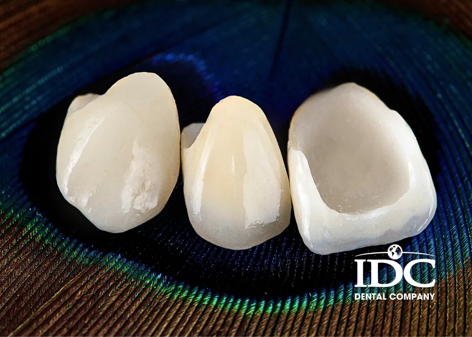 Who needs a Porcelain dental crown?