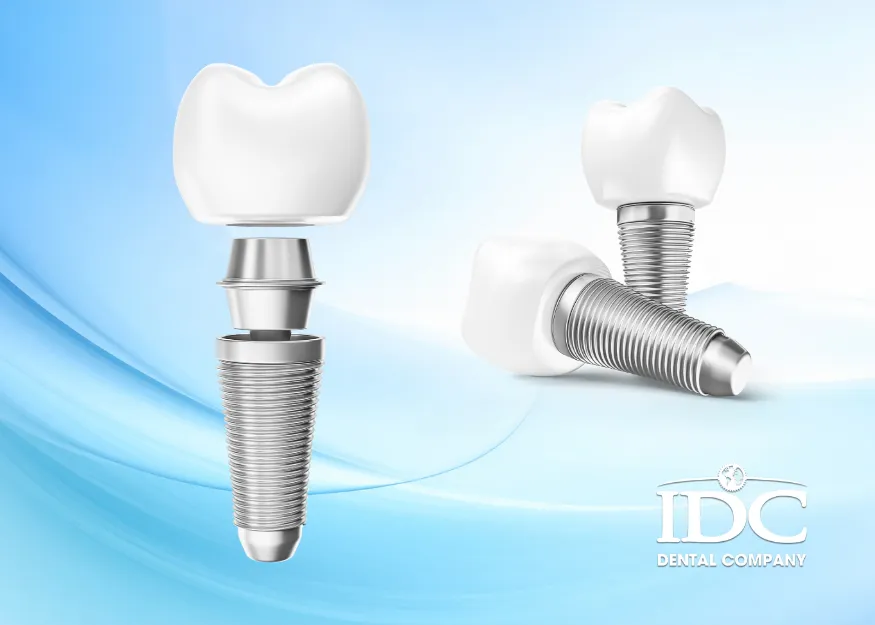 Cấu tạo trụ implant và cơ chế tích hợp xương là gì?