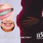 Có nên niềng răng khi mang thai không?