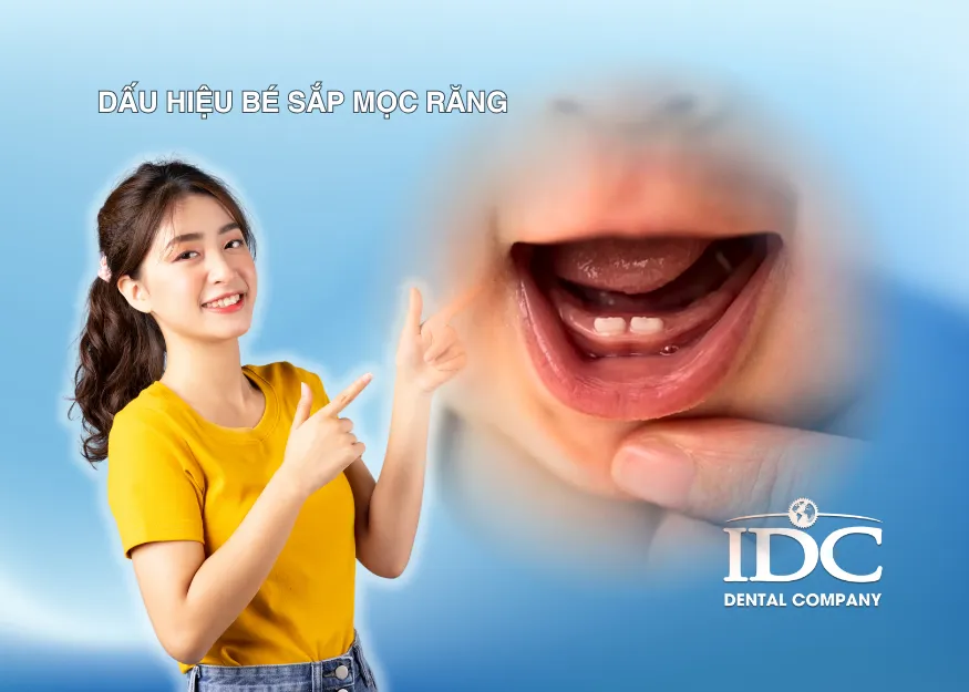 Dấu hiệu bé sắp mọc răng mà ba mẹ không nê bỏ qua