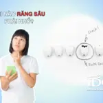 khi nao rang sau can phai nho