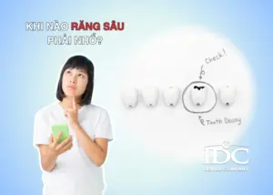 Có nên trồng răng implant không ? Ưu và nhược điểm