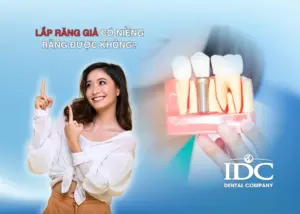 Có nên trồng răng implant không ? Ưu và nhược điểm