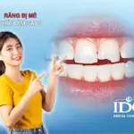 rang bi me phai lam sao