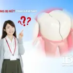 rang bi nut phai lam sao