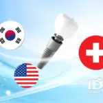 So sánh các loại trụ implant