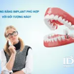 Những ai phù hợp để trồng răng implant?