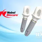 Trụ implant Nobel có tốt không?