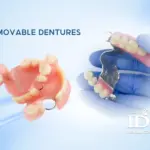 Are Removable Dentures a Good Option 11zon