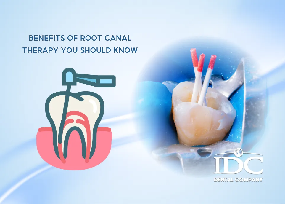 Benefits of Root Canal Therapy You Should Know
