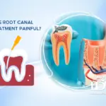 Is Root Canal Treatment Painful?